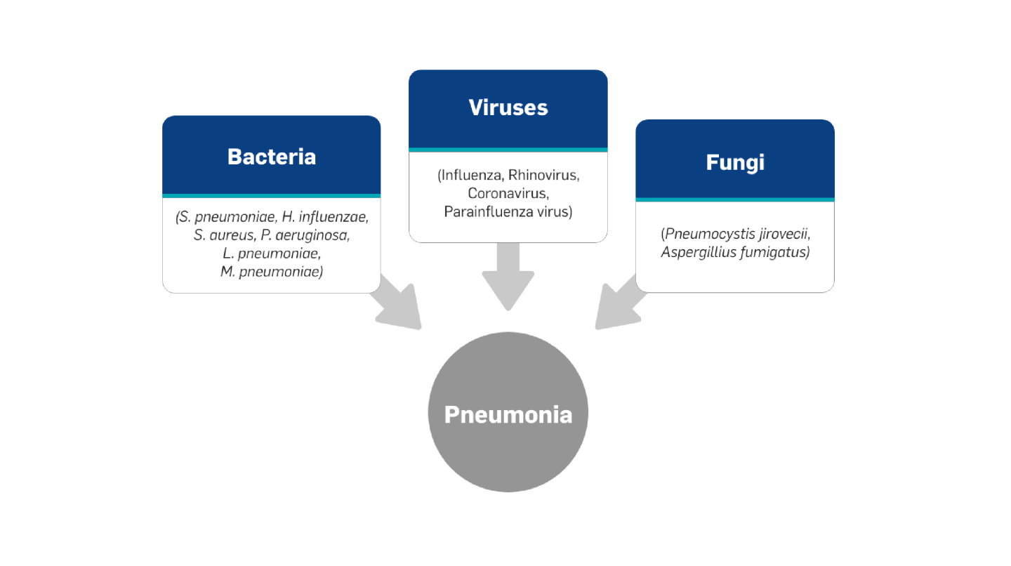 Causes of Pneumonia