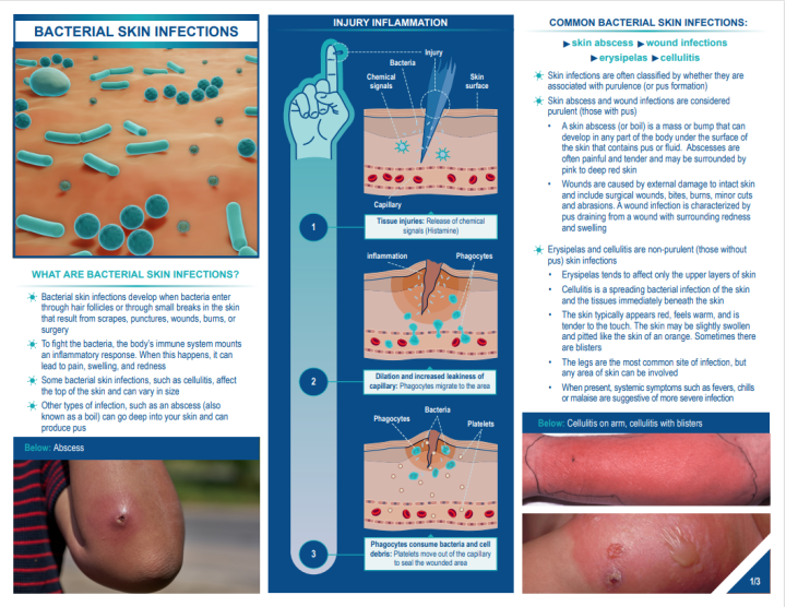 Bacterial Skin infections